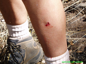 The wound from Cheetah's brutal log stabbing incident.